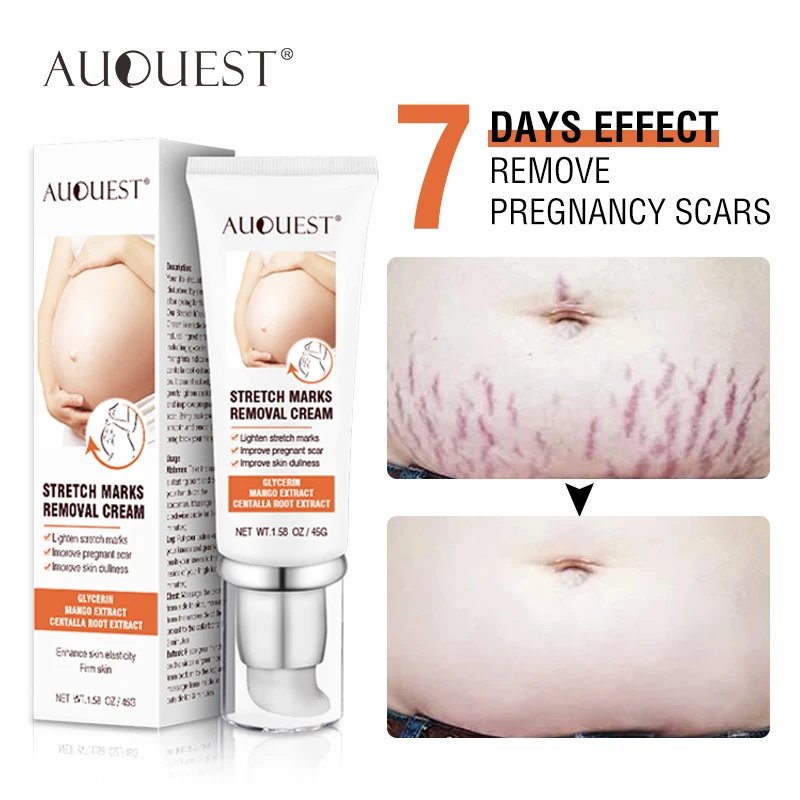 

AUQUEST Stretch Marks Removal Cream For Pregnant Women Firming Whiten Toned Scars Buttock Belly Cream Anti-Winkle Body Care 45g