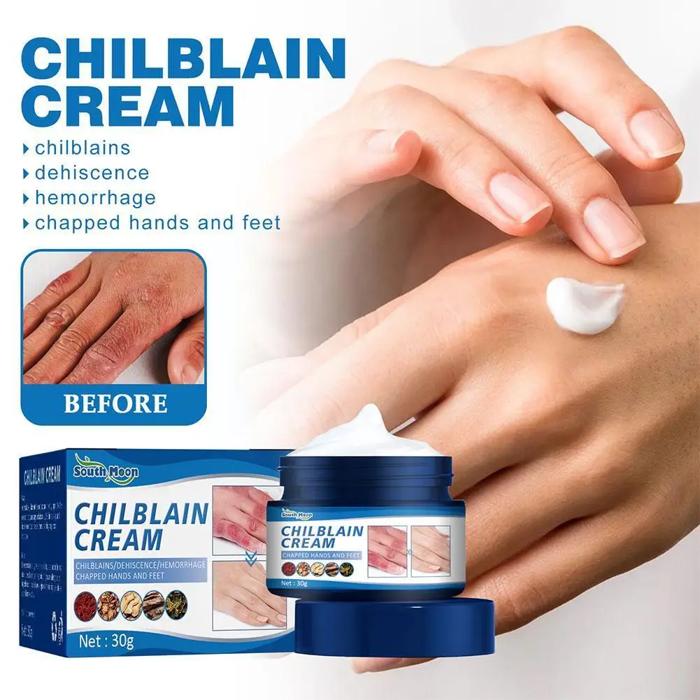 

30g Chilblain Cream Prevent Skin Cracked Anti-drying Feet Cream Anti-freeze Skin Peeling Moisturizing Repair Heel Relieve S W9P3