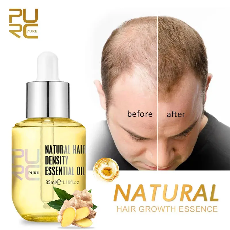 

Средство для роста волос PURC Ginger Essentials, спреи для мужчин и женщин, искусственное масло, мужские искусственные волосы, красота, здоровье