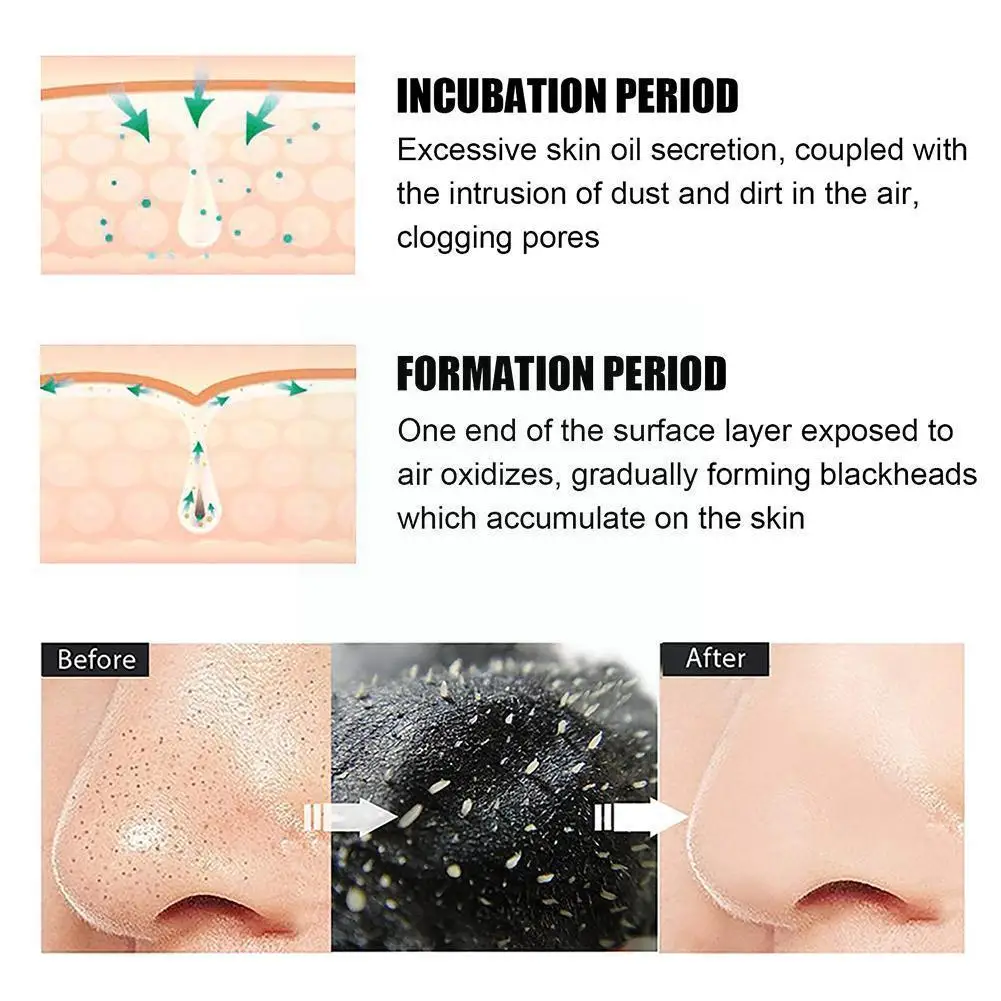 

Bamboo Charcoal Nose Blackhead Remover Deep Cleansing Pore Treatment Strips Care Acne Skin Treatment Shrink Nose A4z8