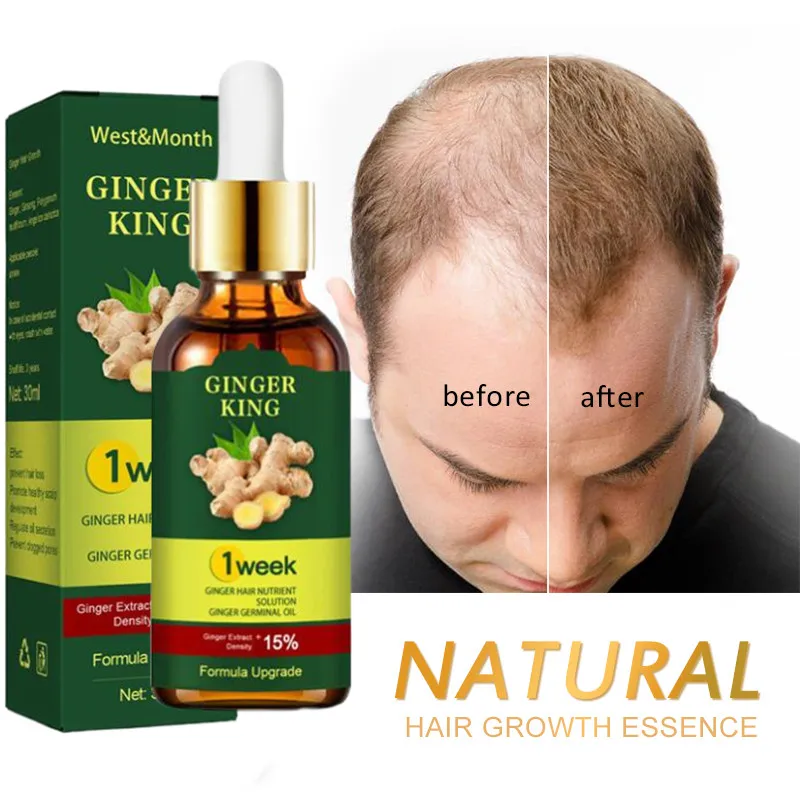 

Natural Hair Growth Essence Thickener Regrowth Serum Treatments Oil Fast Grow Hair for Hair Loss Care Products Men & Women