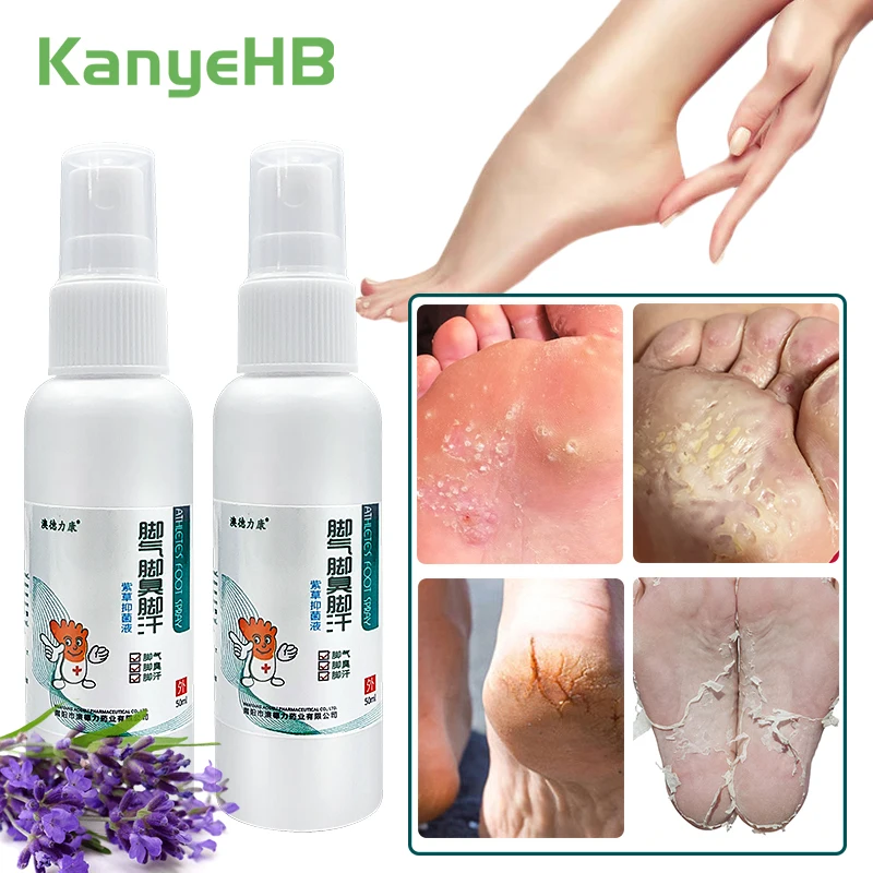 2 шт. антибактериальный крем для ног от зуда |