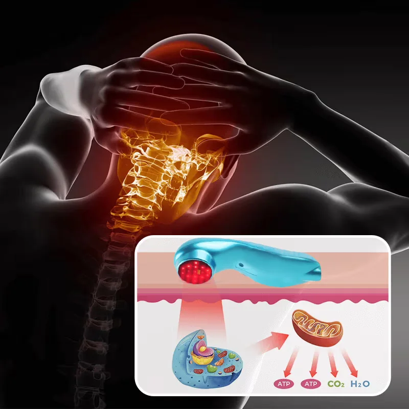 LLLT перезаряжаемое 810 нм 650 удобное устройство холодной лазерной терапии для
