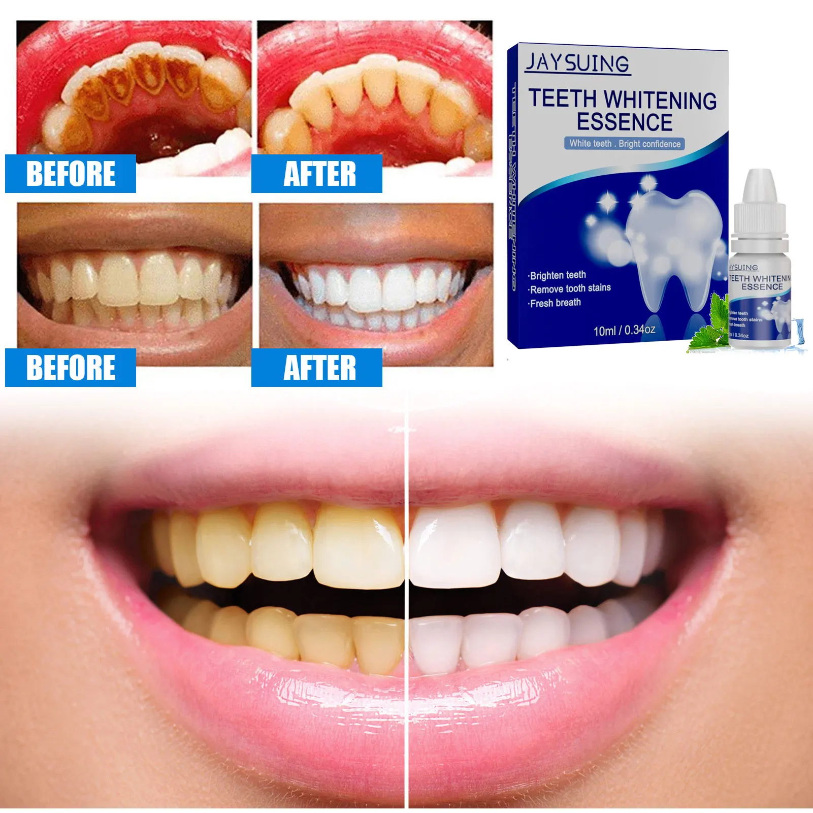 

Teeth Whitening Essence Oral Hygiene Products Dental Care Tools Tooth Bleaching Cleansing Yellow Teeth Dental Care