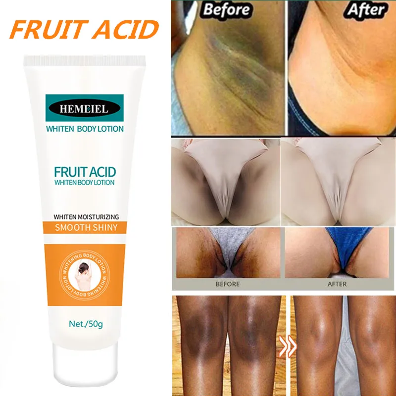 

Whitening Cream Fruit Acid Body Cream Private Bleach Remove Melanin Pigmentation Underarm Knee Buttocks Brighten Skin Beauty
