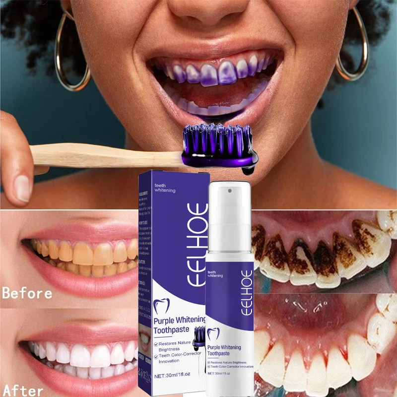 

Sdotter New Teeth Cleansing Whitening Toothpaste Removes Stains Colour Corrector Repair Bleaching Tools Fresh Breath Beauty Heal