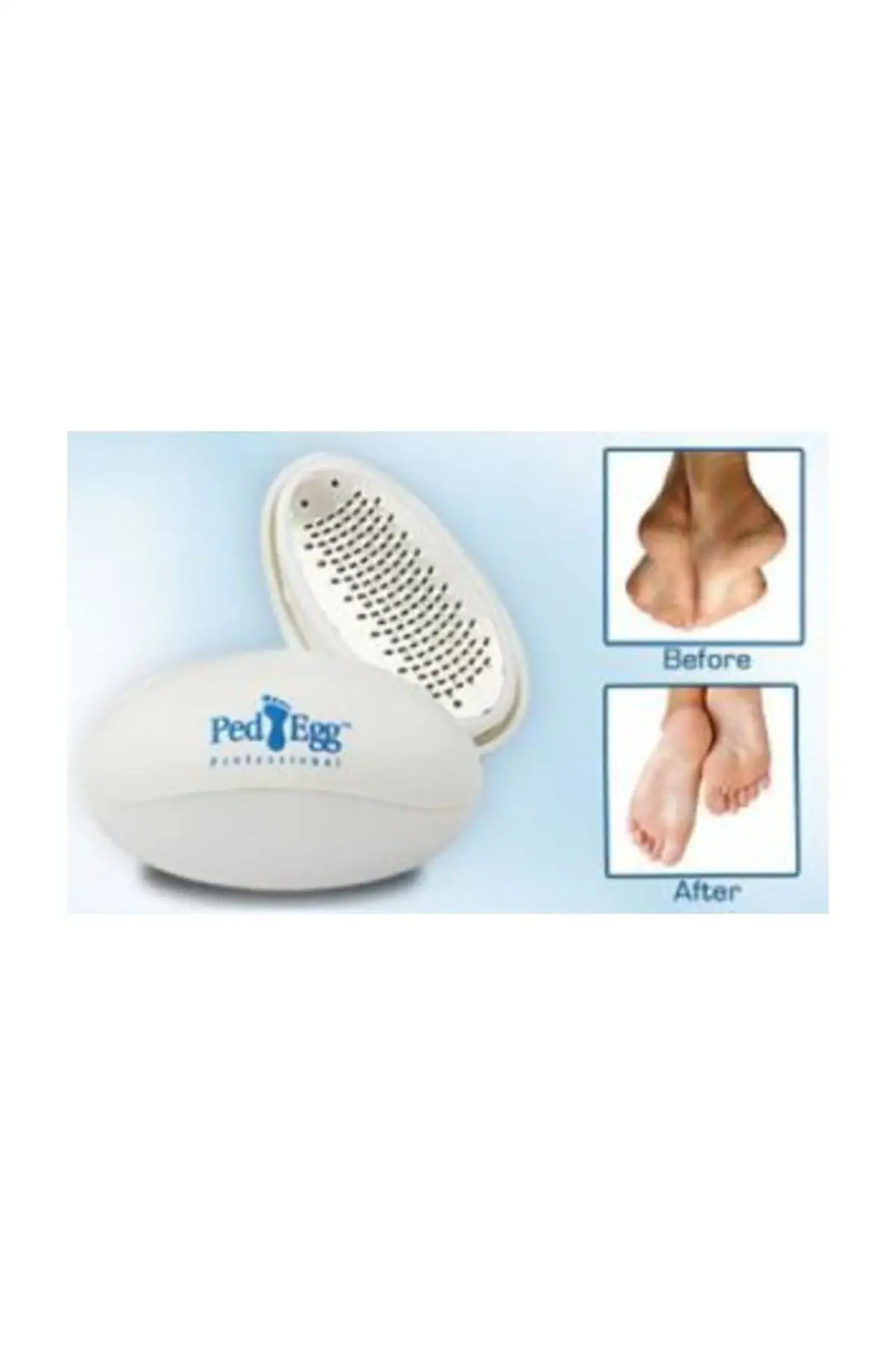 Пилка для пяток Ped Egg уход за ногами ножная пилка ног Сливочная решетка внутренняя