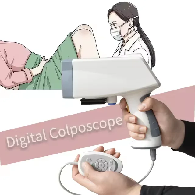 Ручной кольпоскоп ccd SD Digital Colposcope kn-2200 для гинекологии осмотра влагалища
