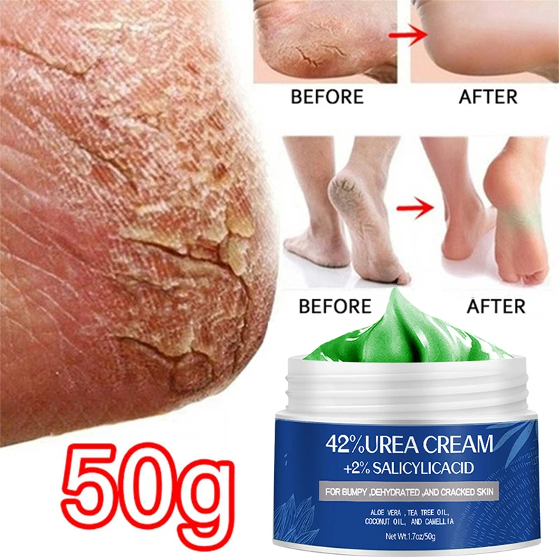 

It is applicable to dry cracked feet, hands, heels, elbows, knees, deep moisturizing and softening skin, and removing dead skin
