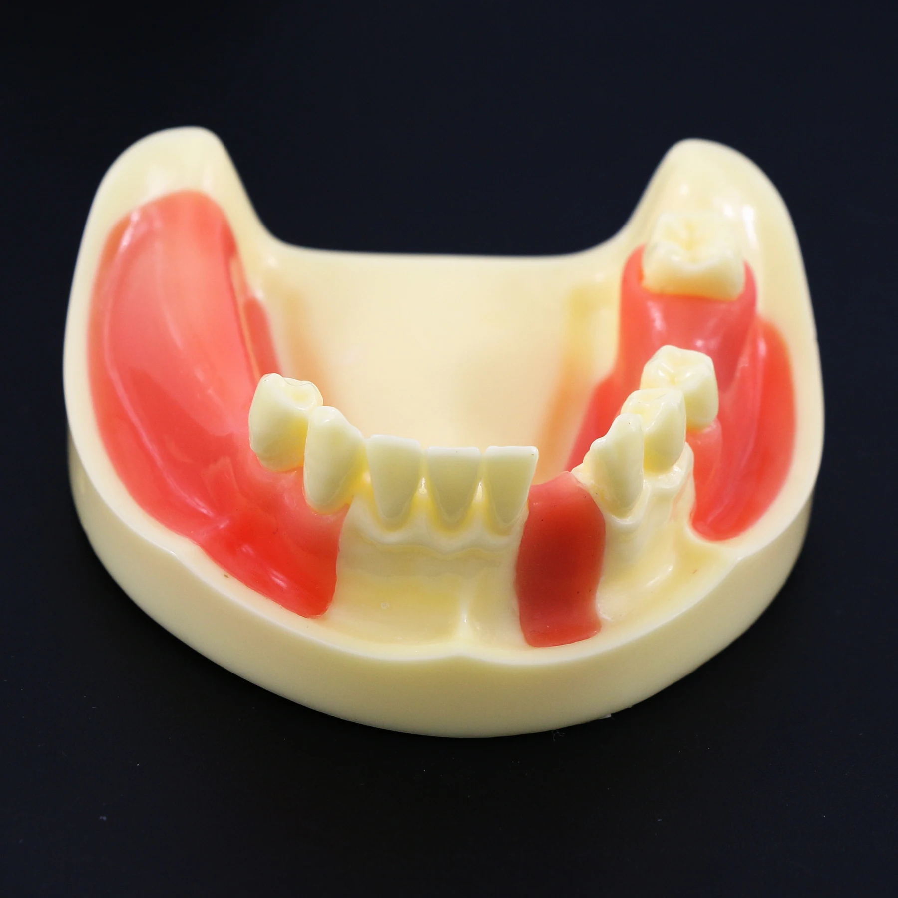 Модель зубного импланта модель для стоматологии тренировочный десен швы