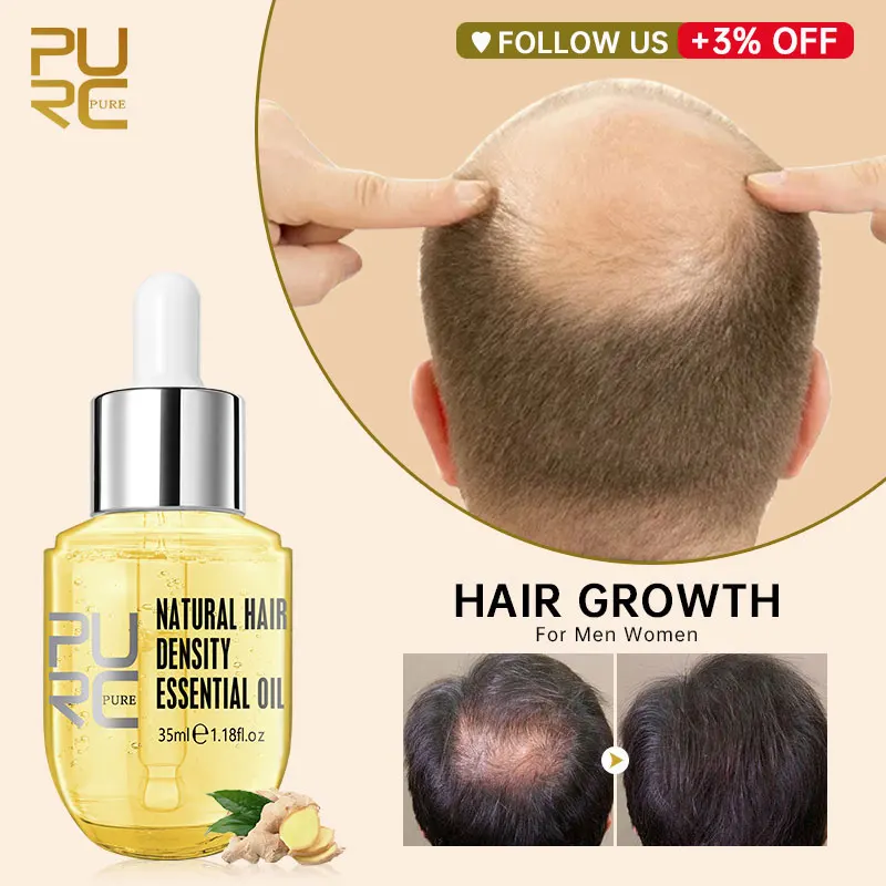 PURC Ginger Essentials Hair Growth Sprays Products For Men Women Fast Regrowth Oil Hair Scalp Treatment Hair Grow Beauty Health