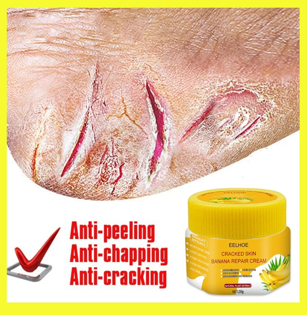 

Banana Anti Crack Foot Cream Heel Cracked Repair Oil Remove Dead Skin Callu Nourish Anti-Dry Smooth Winter Hand Feet Beauty Care