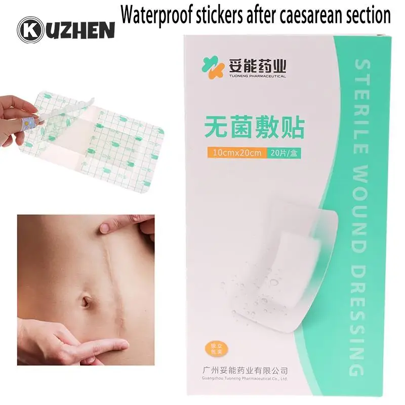 

20 шт., пластырь для удаления шрамов от акне, 20 х10 см