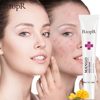 rtopr mango repair acne cream whitening repair more radiant acne treatment face remove freckles
