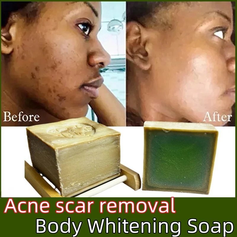 Отбеливающее мыло для тела отбеливающее подмышек и колен удаление куриной кожи