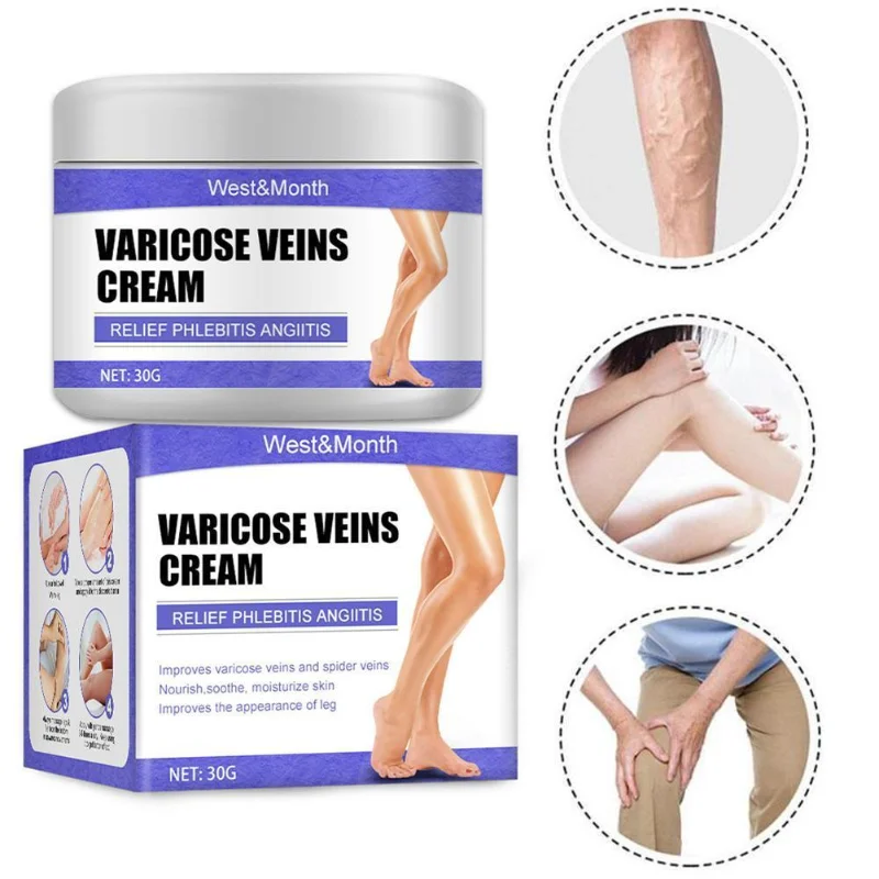 

Effective Varicose Veins Relief Cream Relieve Vasculitis Phlebitis Spider Pain Treatment Ointment Medical Plaster Body Care 30ml