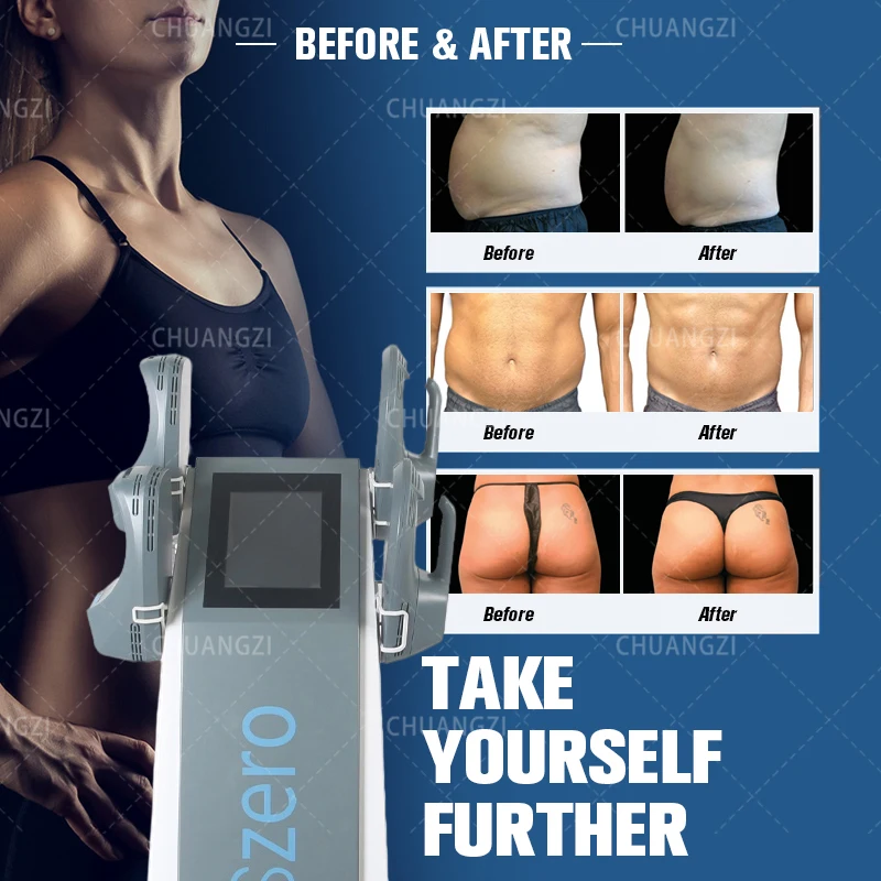

Emslim sport Electromagnetic Body Slimming Muscle emszero Stimulate Fat Removal Body muscle sculpting Machine
