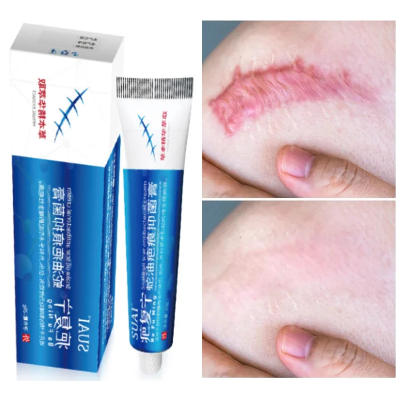 

Acne Scar Cream Repair Stretch Marks Burn Scar Surgery Scar Smoothing Whitening Moisturizing Body Skin Care Products