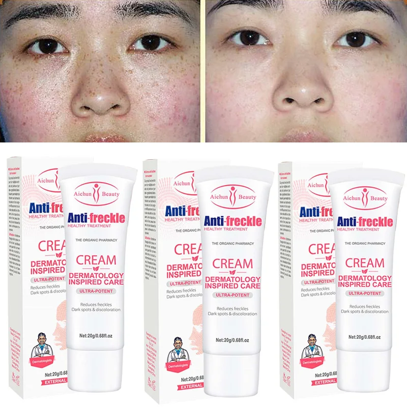 

Nicotinamide Whitening Freckle Cream Remove Dark Spots Melanin Melasma Brighten Face Cream Pigmentation Anti-Aging Skin Care