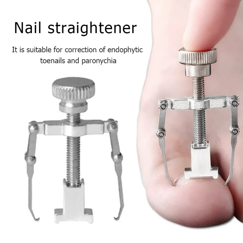 

Ingrown Toenail Fixer Toe Recover Correction Device Toe Corrector Toenail Straightening Clip Pedicure Foot Nail Care
