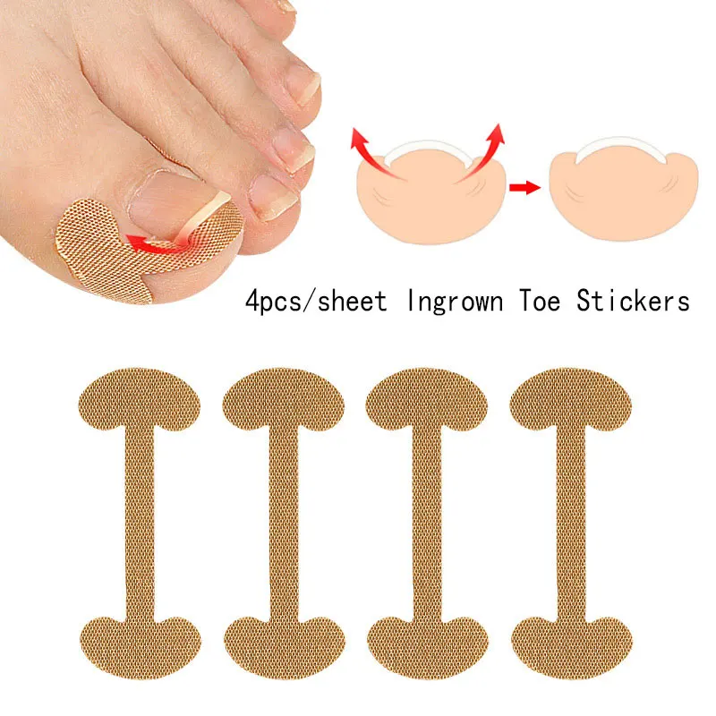 

Nail Enhancement Foot Nail Groove Embedded Foot Nail Corrector Nail Roll Patch