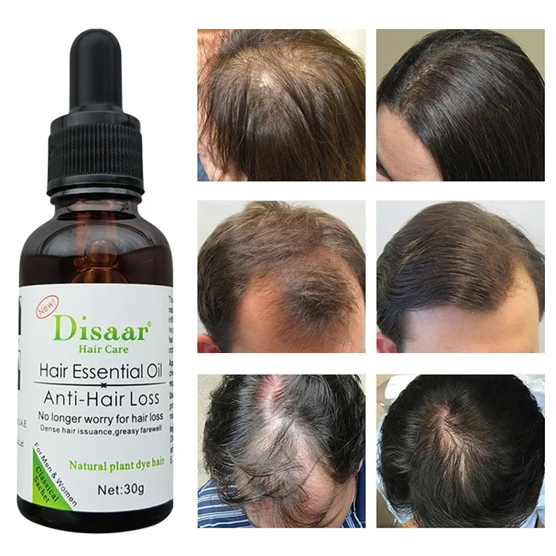 

Sdotter Follicles Repairs Hair Growth Plant Esential Oil Fast Anti-Hair Loss Regrowth Serum Products Treat Thinning Hair Scalp C