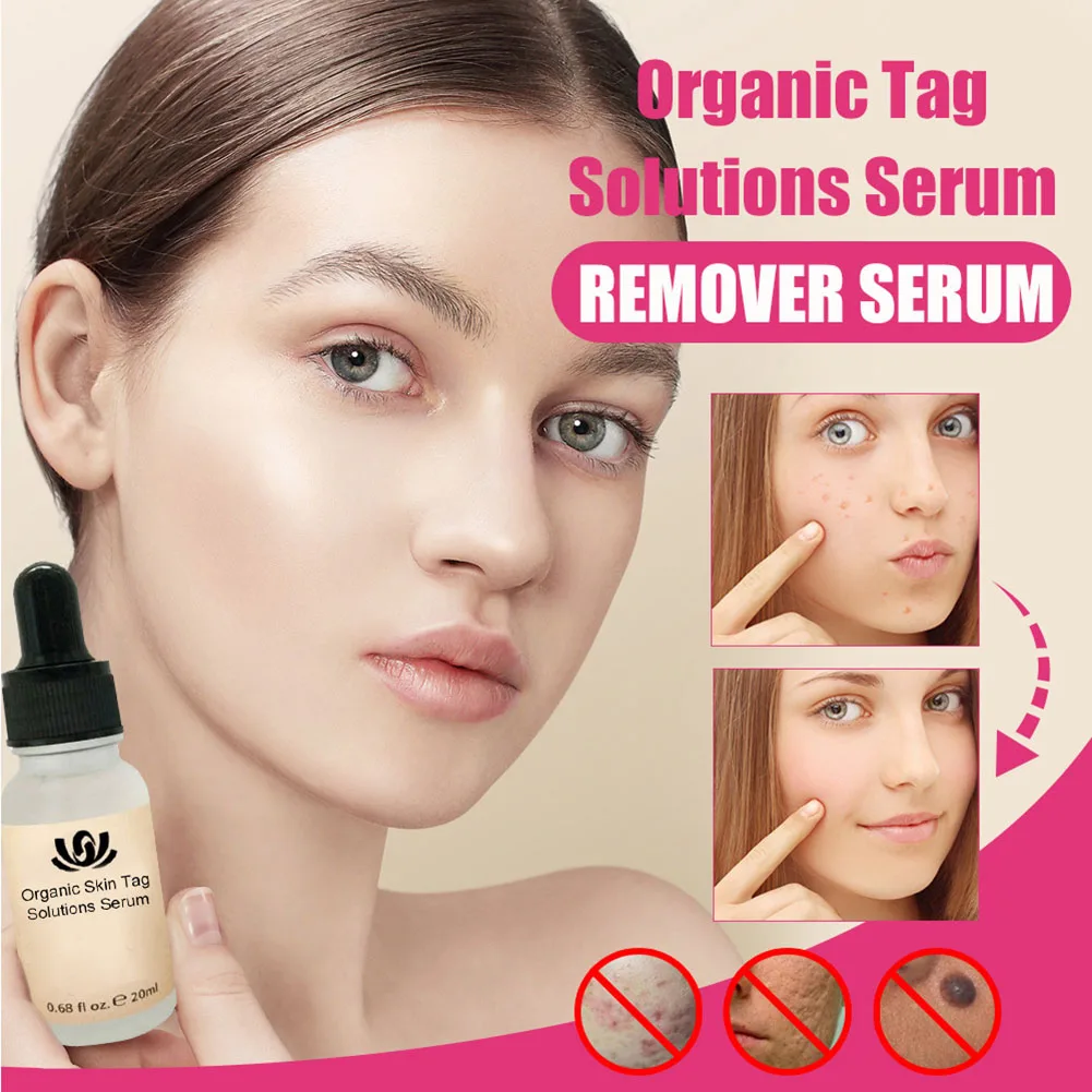 

Organic Tags Solutions Serum Painless Mole Skin Dark Spot Remover Serum Freckle Face Wart Tag Removal Essential Oil 20ml