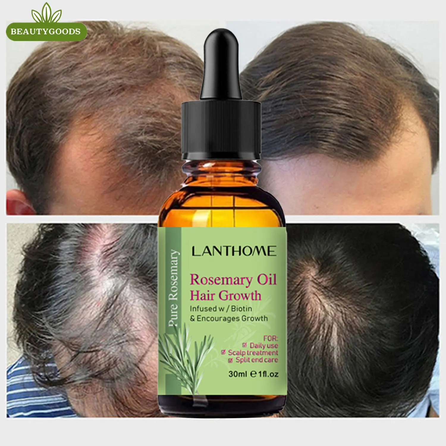 

1 Pc Hair Growth Products Rosemary Anti Loss Oil Anti-loss Scalp Dry Frizzy Treatment Strong Root Essential Oils Follicles Care