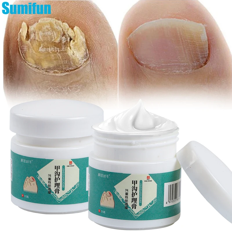 

15g Nail Fungus Removal Cream Onychomycosis Fungal Nail Treatment Paronychia Anti Infection Feet Toe Fungal Nail Care Ointment