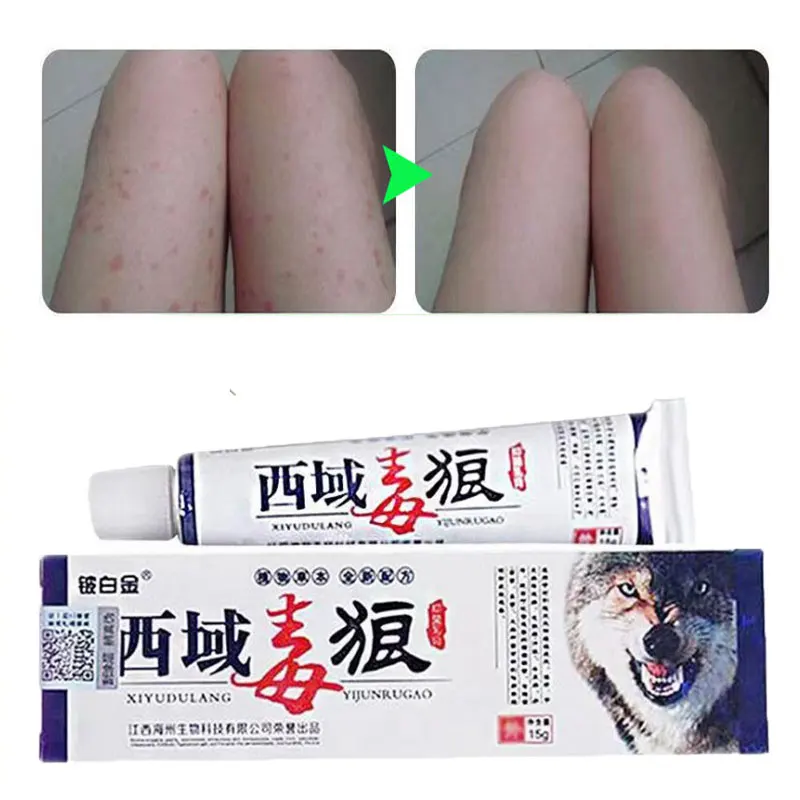 

Perfect For Dermatitis and Eczema Pruritus Psoriasis Ointment Herbal Creams Advanced Body Psoriasis Cream