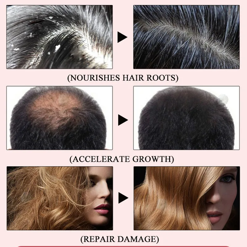 

Hair growth High quality Fo-ti Extract Powder Polygonum multiflorum root He shou wu adjustable women/men sex Promoting