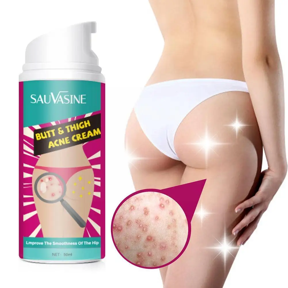 

Крем для лечения прыщей на ягодицах и бедрах, 50 мл