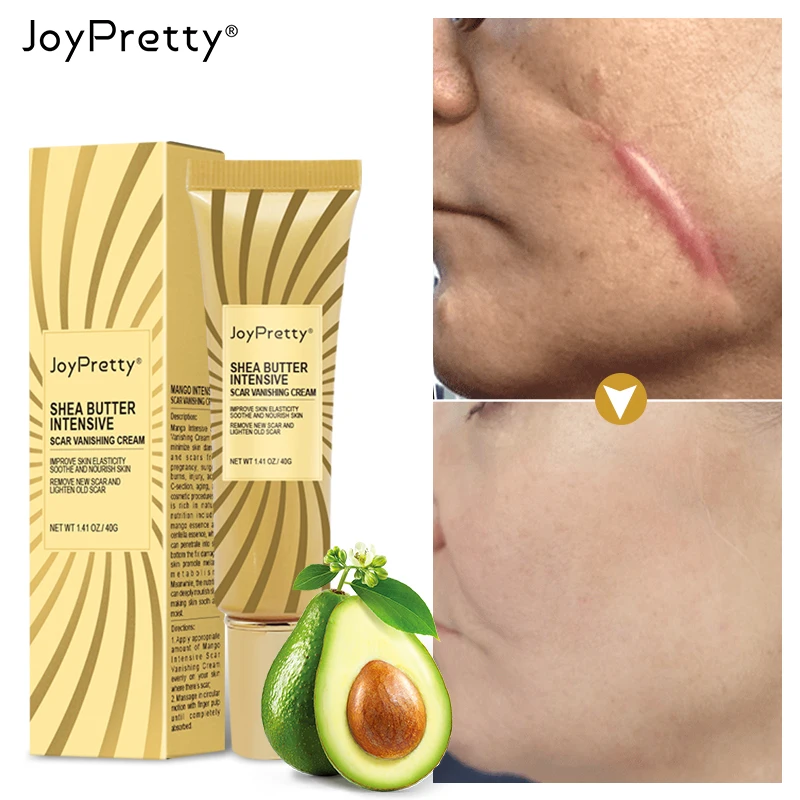 

JoyPretty Shea Butter Scar Removal Face Cream Sunburn Burns Old Scars Fade Whiten Smooth Stretch Marks Body Treatment Skin Care