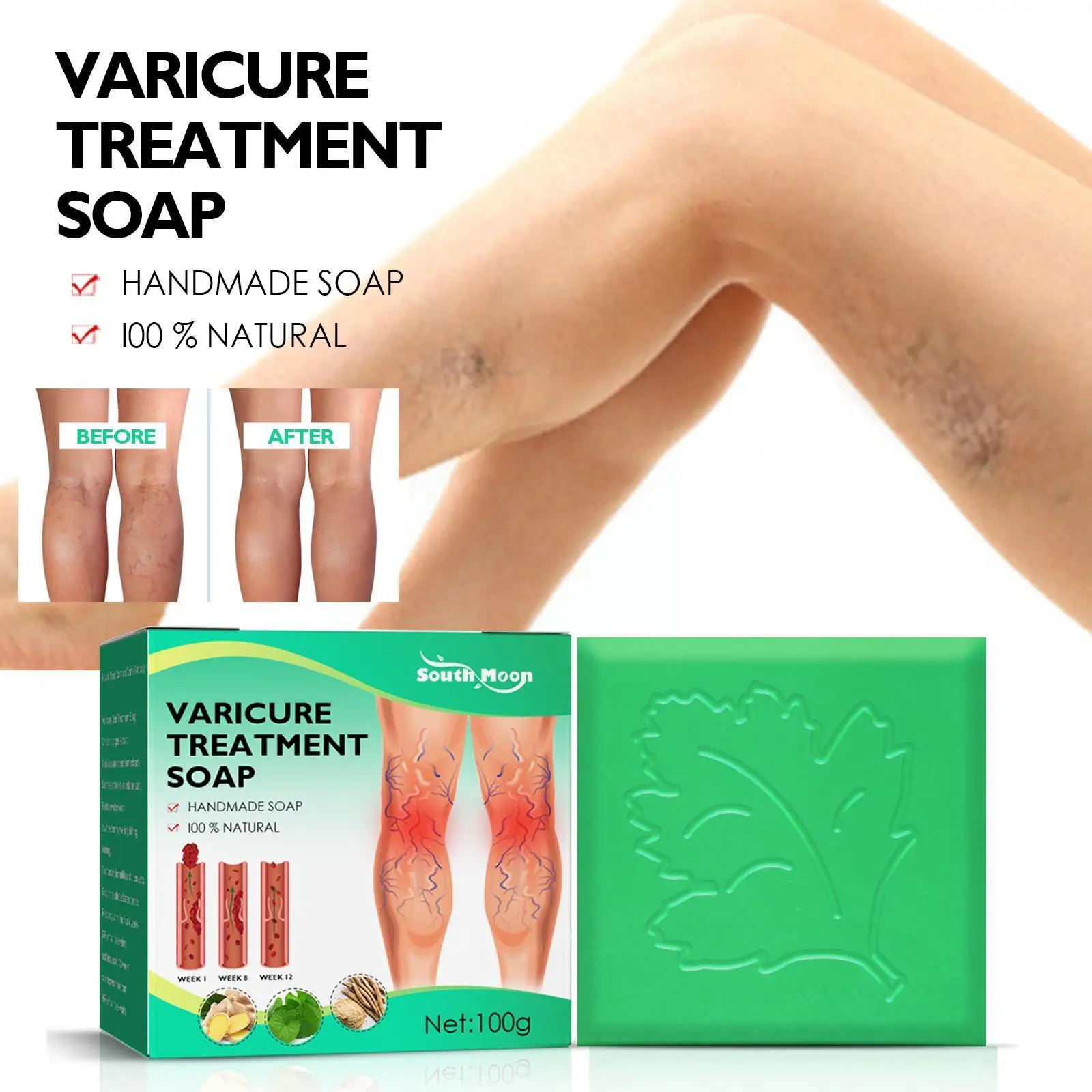 

Мыло для лечения варикозного расширения вен, 100 г, средство для снятия симптомов боли в ногах Earthwor M2e4