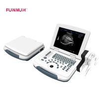 portable color doppler ultrasound scanner colour doppler ultrasound scanner
