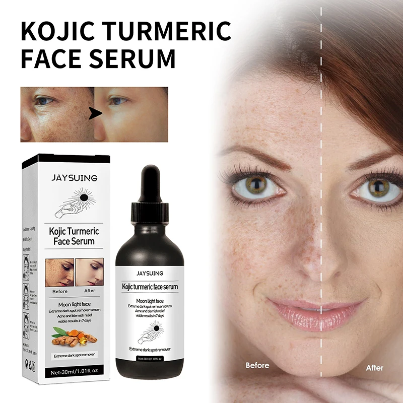 

Freckle Whitening Face Serum Turmeric Oil Fade Dark Spot Brighten Removal Pigment Melanin Correcting Essence Beauty Skin Care