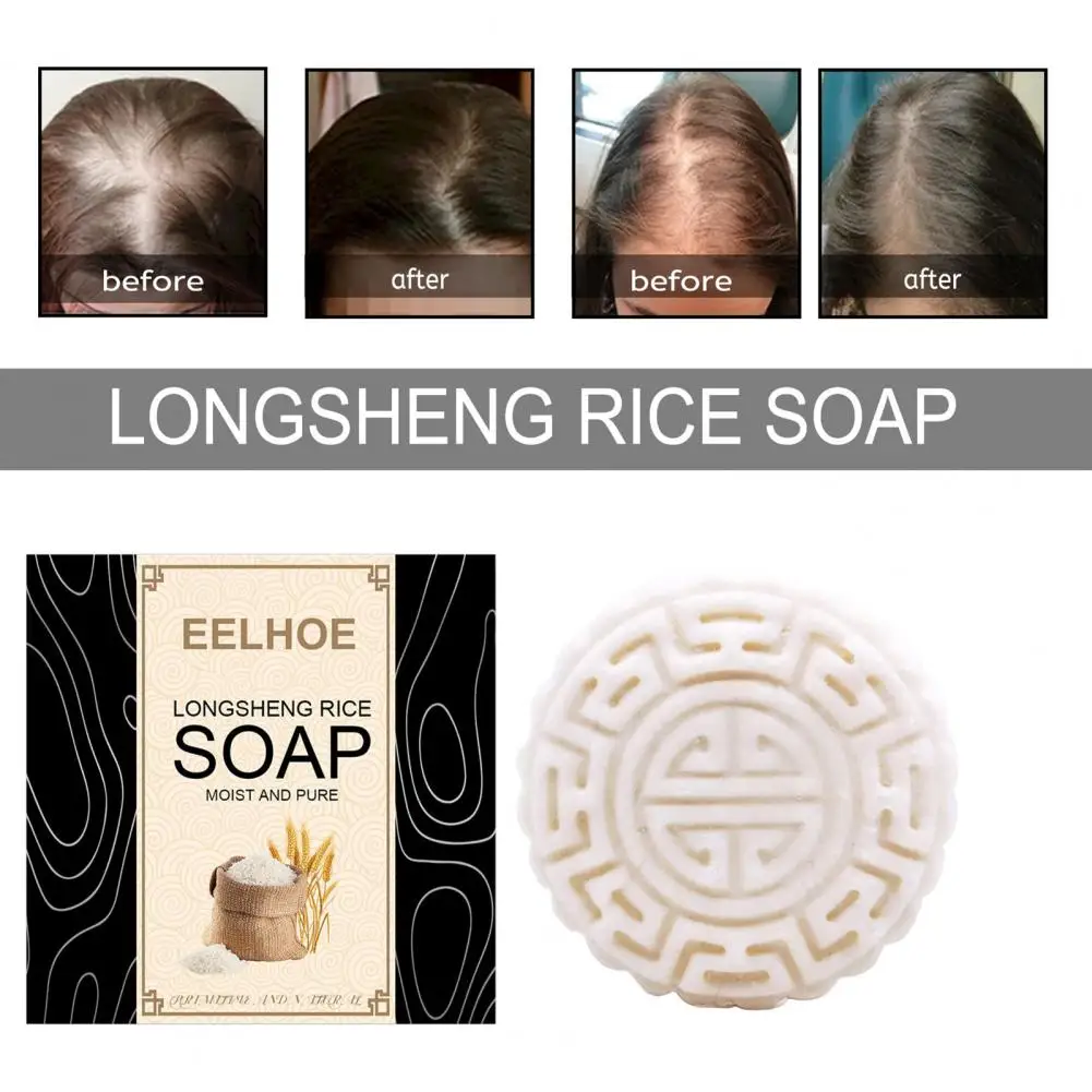 

Remove Greasy Significant Effect Anti-hair Loss Shampoo Soap for Ladies