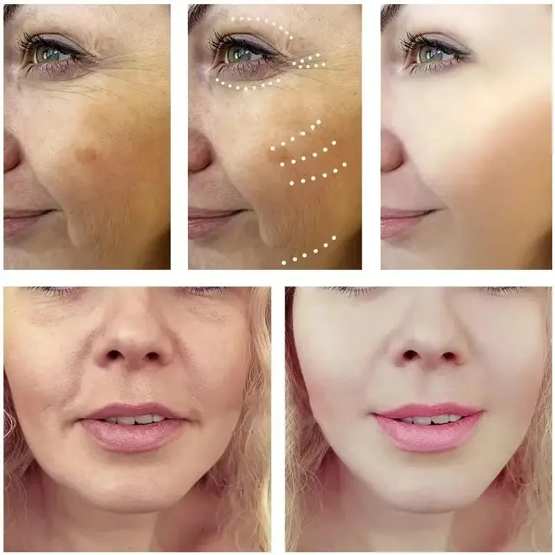 Кровь дракона быстрое удаление морщин сыворотка для лица плацента королевская