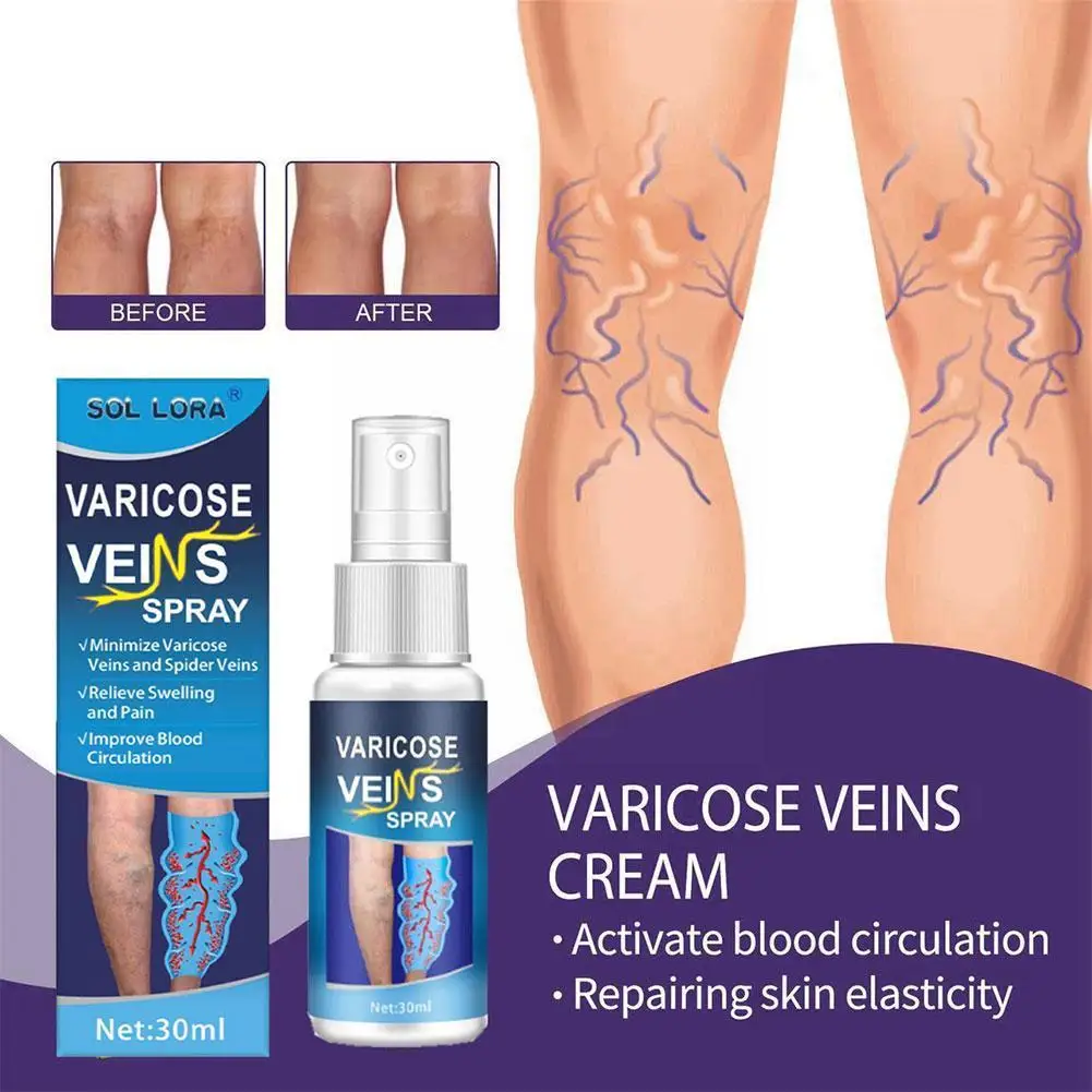 

1pc Veinhealing Varicose Veins Treatment Spray Smoothen Of Bulge Surgery Earthworm Care Leg The Without Vessels Blood Legs F5K1