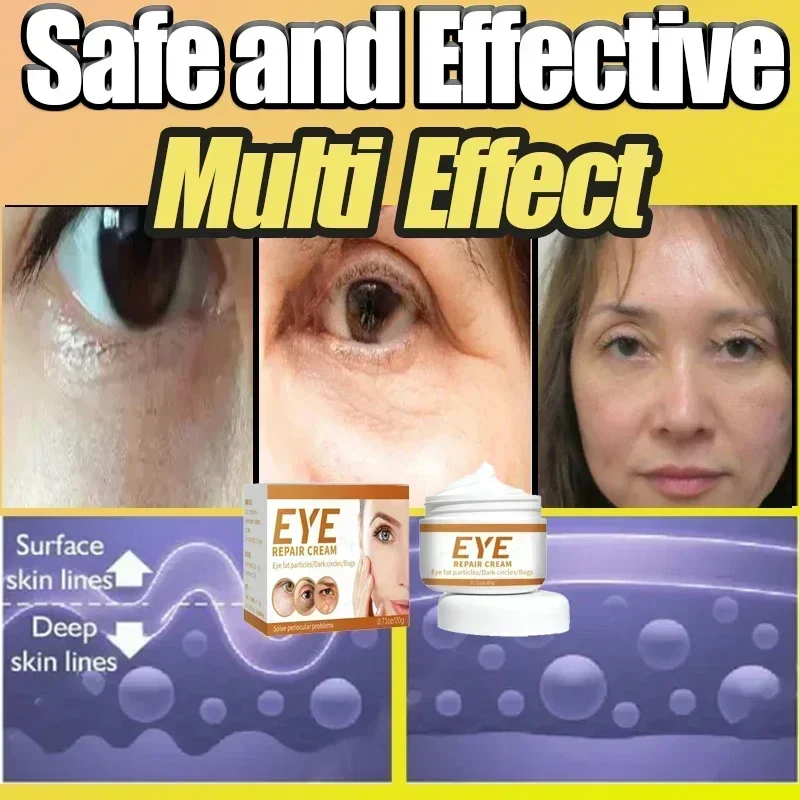 Крем для области вокруг глаз от Тёмных кругов и мешков под глазами