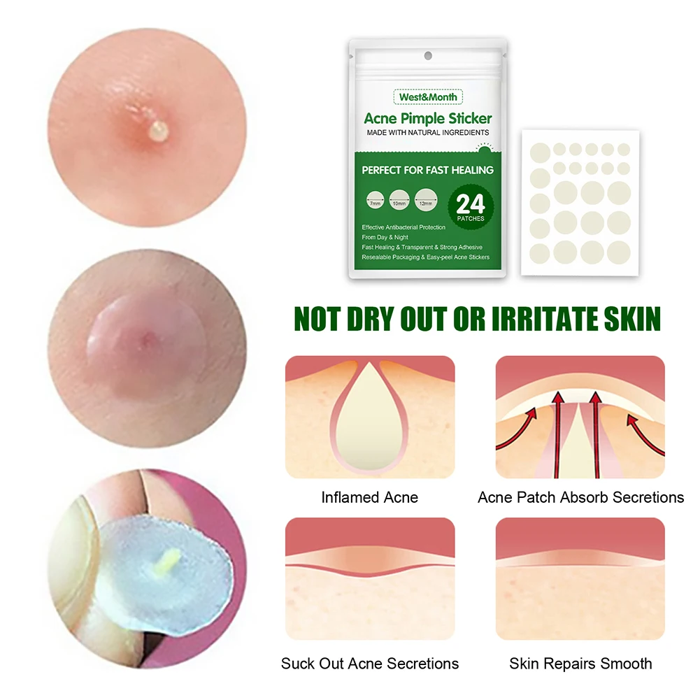 

24-360pcs Acne Pimple Remover Patch Invisible Dot Spot Hydrocolloid Fast- Acting Clean Deep Blemish Facial Skin Care Beauty Tool