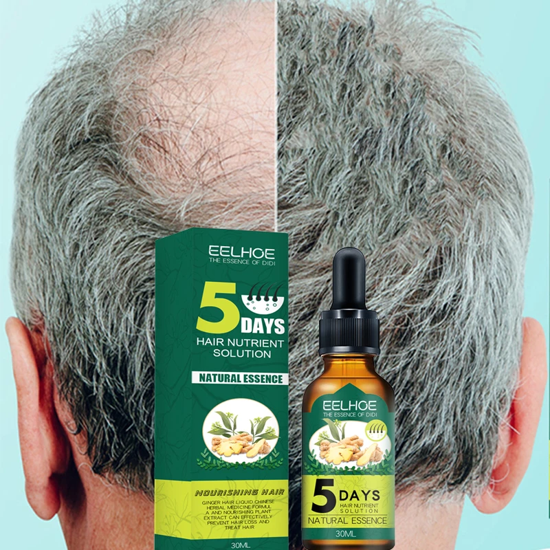 

5 Days Ginger Hair Growth Oil Natural Anti Hair Loss Prevent Baldness Treatment Fast Growing Nourish Dry Damaged Hair Care