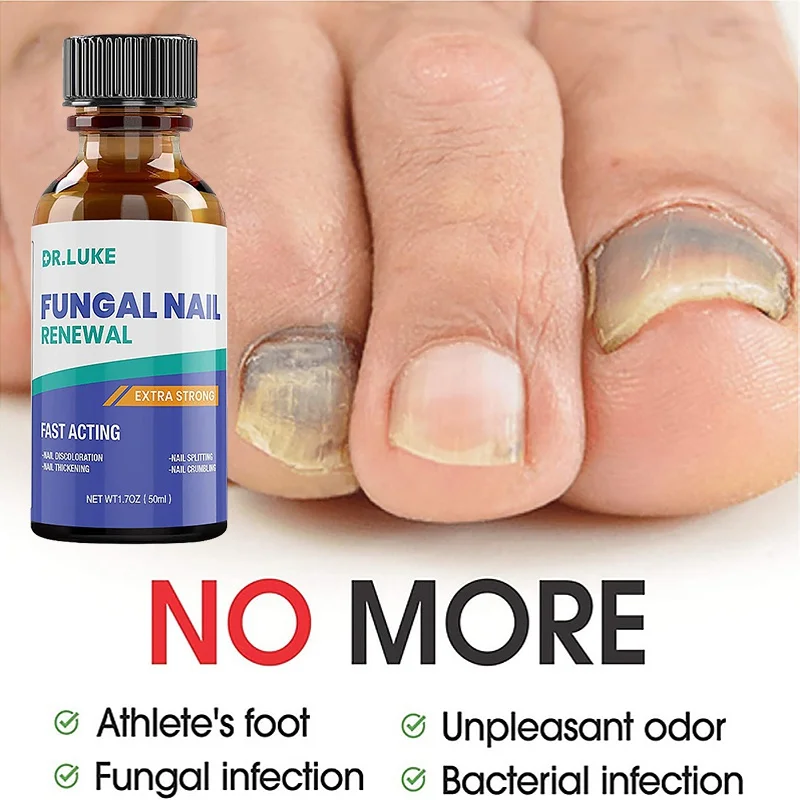 

HOT Nail Fungus Treatment Stop Fungal Growth Effective Fingernail & Toenail Health Care Solution Fix & Renew Damaged Cracked
