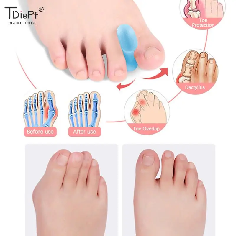 

1Pair Silicone Toe Separators Foot Clamp Separator For Adult Kids Thumb Valgus Toe Fold Toe Orthosis Anti Abrasion Toe Divider