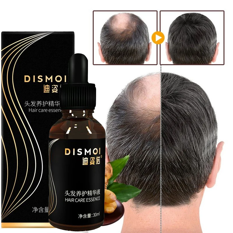 

30ml Hot Hair Growth Essential Oil Fast Growing Hair Oil Nourishing Prevent Hair Loss Thinning Repair Damaged Hair Care Products