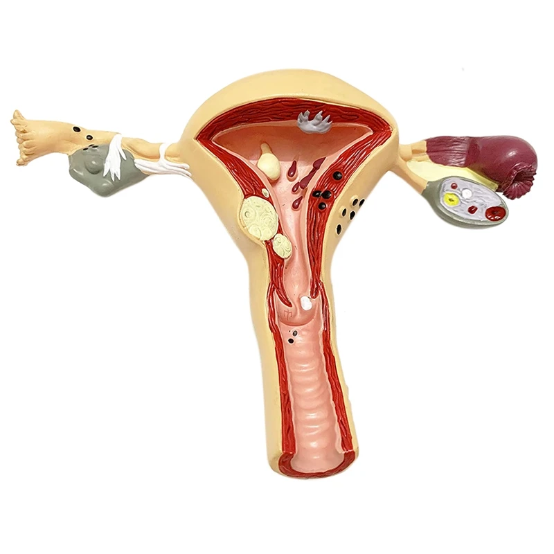 

Human Uterus And Ovary Model, Female Reproductive Organ Model, Female Genital Organ, Medicine Teaching Anatomical