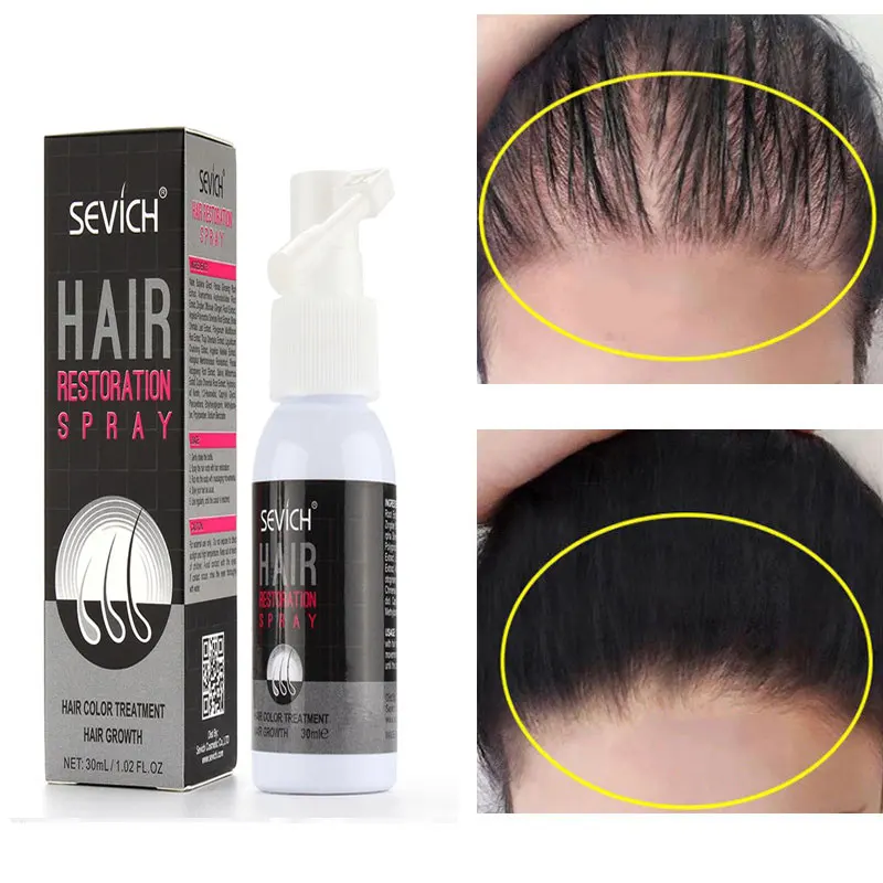 

Ginger Hair Growth Spray Serum Anti Hair Loss Essential Oil Products Fast Treatment Prevent Hair Thinning Dry Frizzy Repair