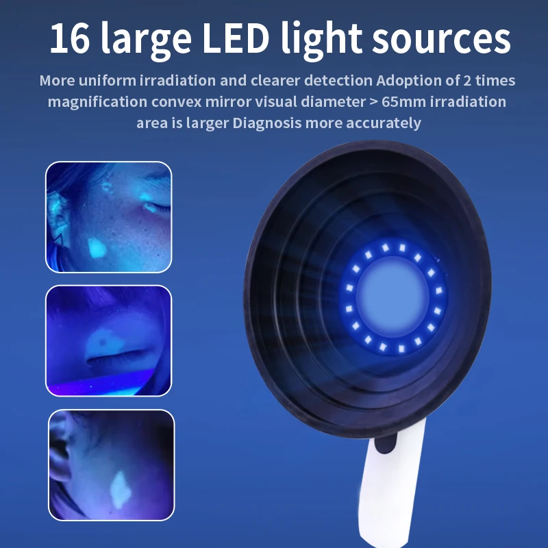 Лампа Вудса анализатор кожи для витилиго УФ-луемное увеличение тестирования