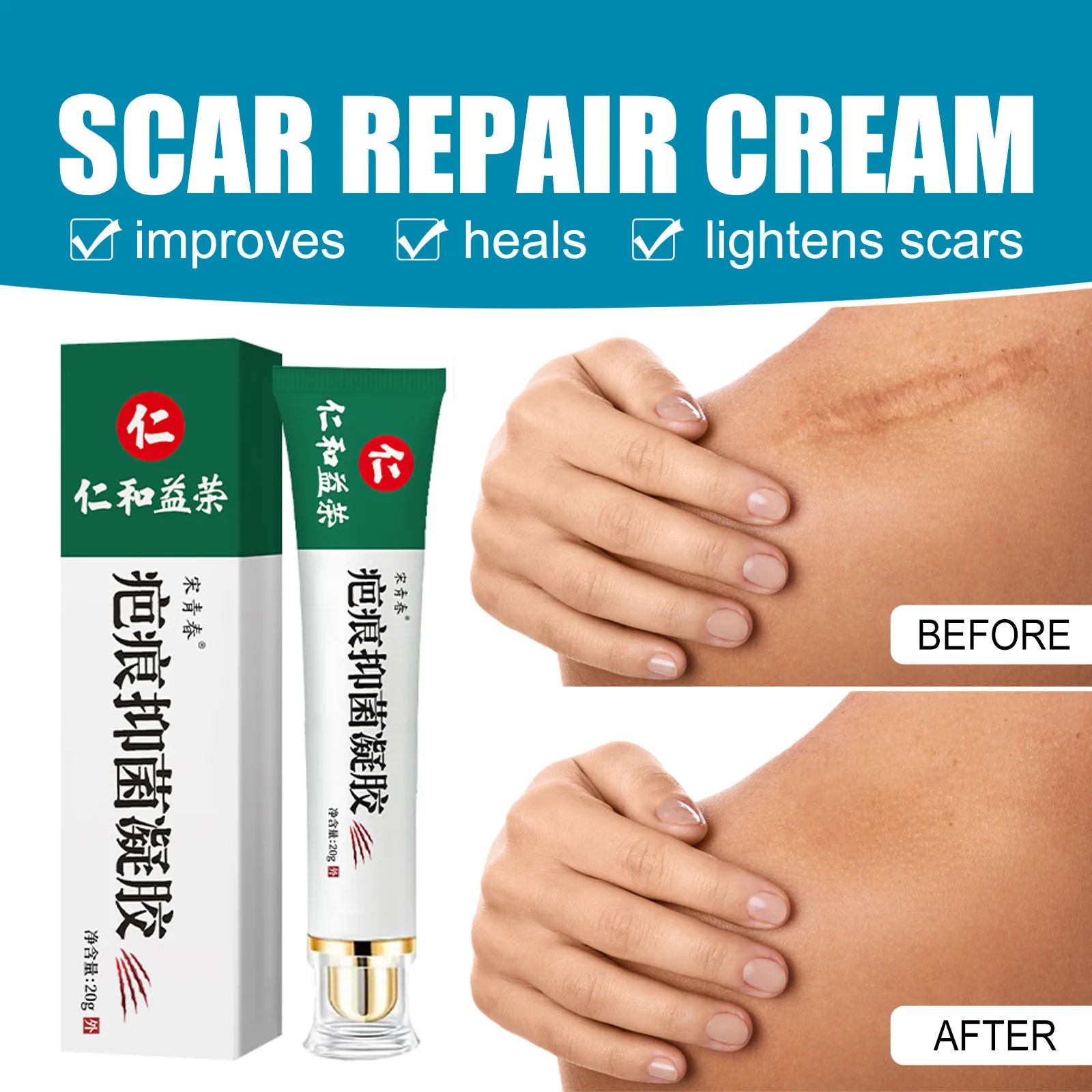 Acne Scar Removal Face Cream Spots Pigmentation Corrector Whitening Anti Stretch Marks Repair Gel Skin Care |