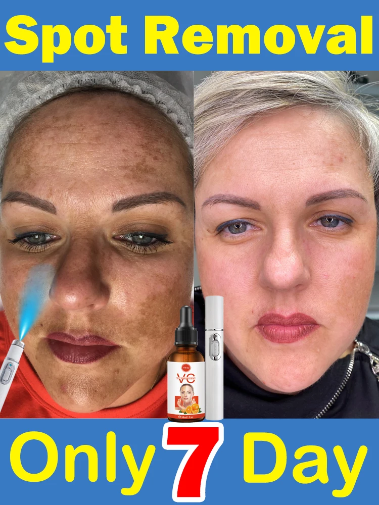 Веснушки Темные века Солнце Пятно Прозрачное